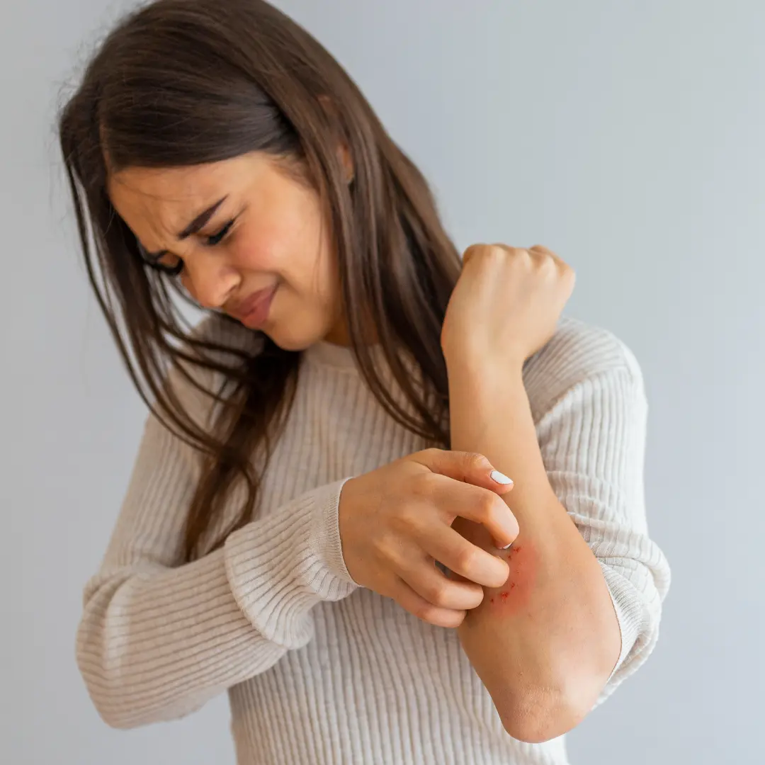 Dermatitis nerviosa dermatologo