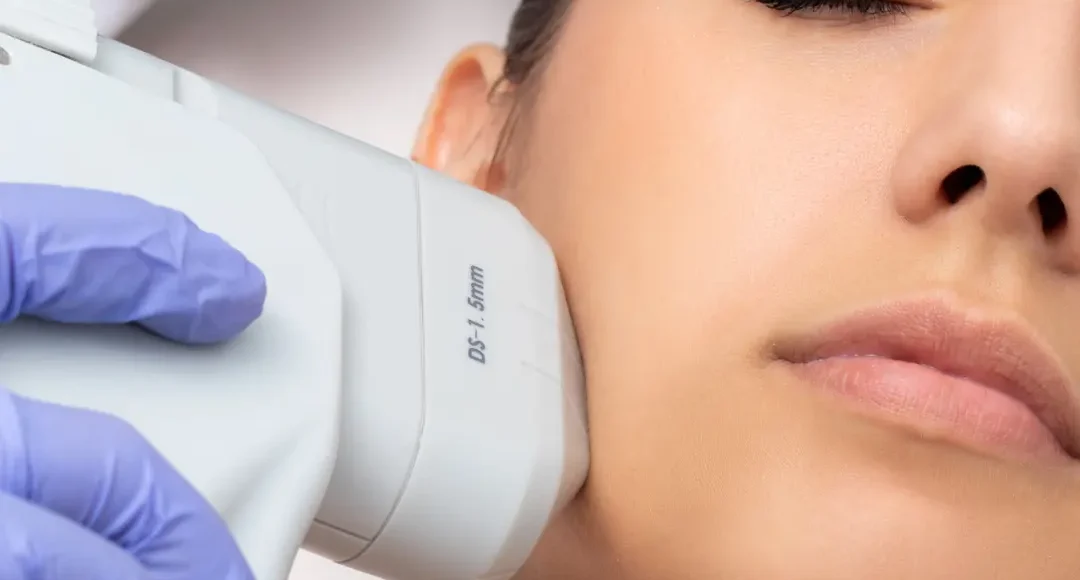 HIFU facial por dermatologo