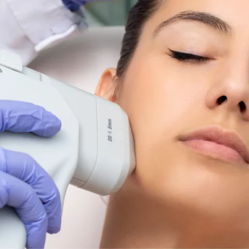 HIFU facial por dermatologo