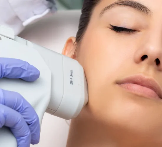 HIFU facial por dermatologo