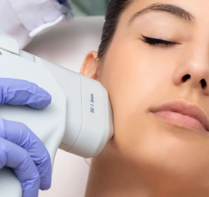 HIFU facial por dermatologo
