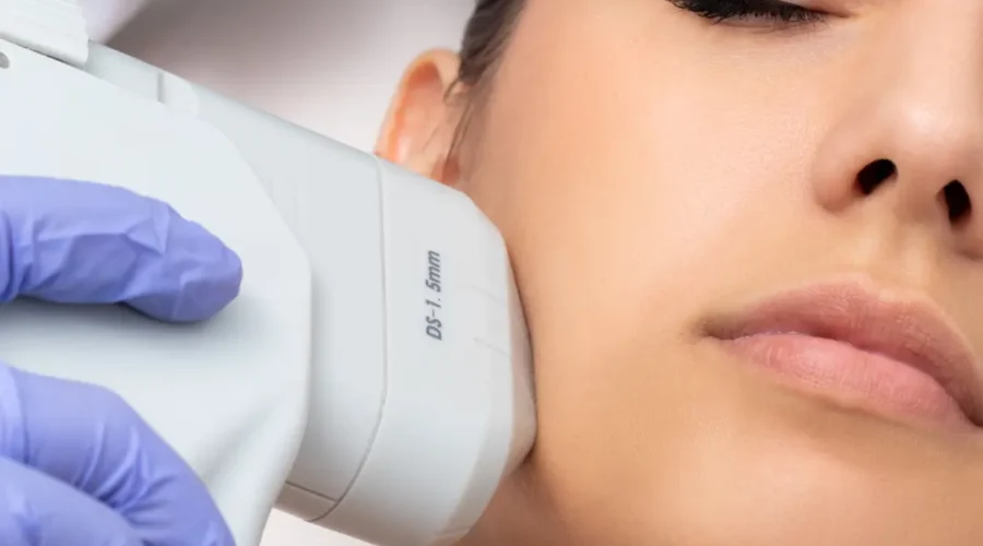 HIFU facial por dermatologo