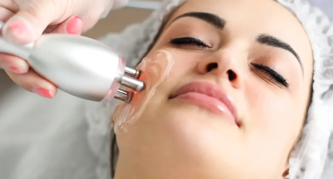 Radiofrecuencia facial