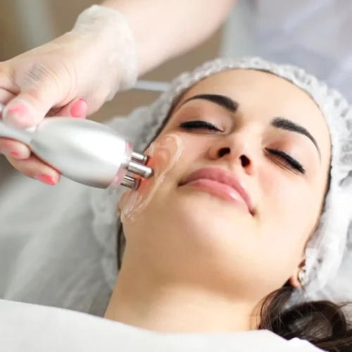 Radiofrecuencia facial