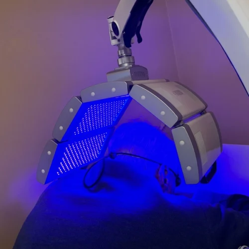 Por qué es dolorosa la terapia fotodinámica