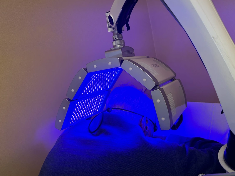 Por qué es dolorosa la terapia fotodinámica